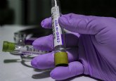 La Región de Murcia ha registrado 352 nuevos contagios por coronavirus, 11 en Totana