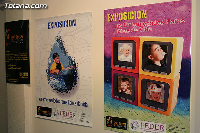 Comienzan los actos para conmemorar el “Da Mundial de las Enfermedades Raras