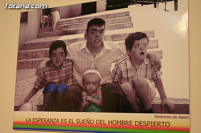 Comienzan los actos para conmemorar el “Da Mundial de las Enfermedades Raras