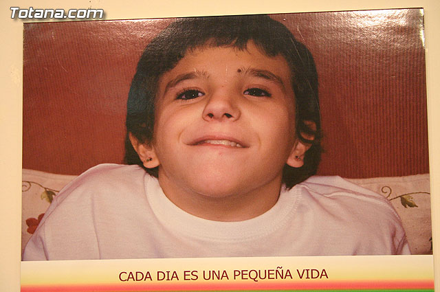 Comienzan los actos para conmemorar el “Da Mundial de las Enfermedades Raras