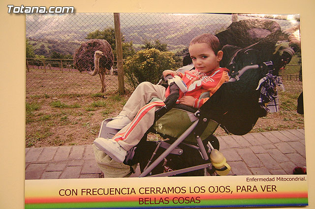 Comienzan los actos para conmemorar el “Da Mundial de las Enfermedades Raras