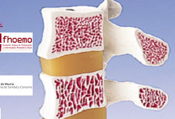 Esta tarde se celebrará una jornada sobre la osteoporosis en el Campus Universitario de Lorca - 1, Foto 1