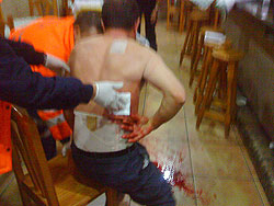 El herido recibió las primeras curas médicas en el mismo lugar donde ocurrieron los hechos*. , Foto 1