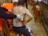 Un vecino de Abarn result herido por arma blanca en un cntrico bar del municipio