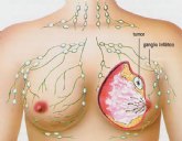 Concluye en Jumilla la campaña de prevencin del cncer de mama con la realizacin de ms de 1600 mamografas