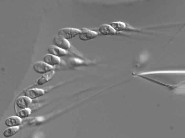 El Instituto Murciano de Fertilidad ha incorporado de forma pionera una de las tecnologías más eficaces del mercado - 2, Foto 2