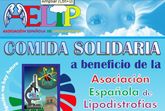 El 1 de diciembre tendrá lugar la comida solidaria a beneficio de la Asociación Española de Lipodistrofias, AELIP