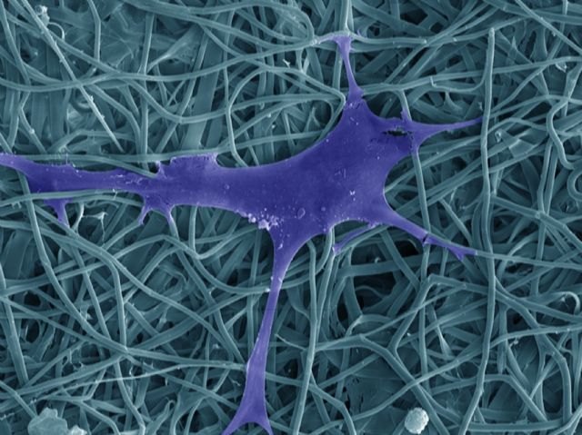 El IMIDA lidera en España la tecnología de los biomateriales de seda para aplicaciones biomédicas - 1, Foto 1