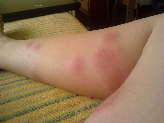 Cambiemos Murcia pide que se tomen medidas contra la plaga de mosquitos en Beniaján - 1, Foto 1