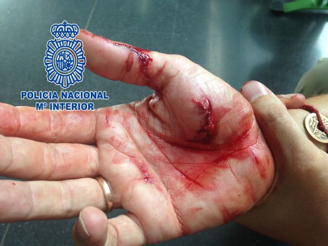 Agente de Policía Nacional herido por un perro al tratar de apartarlo de la vía pública - 1, Foto 1