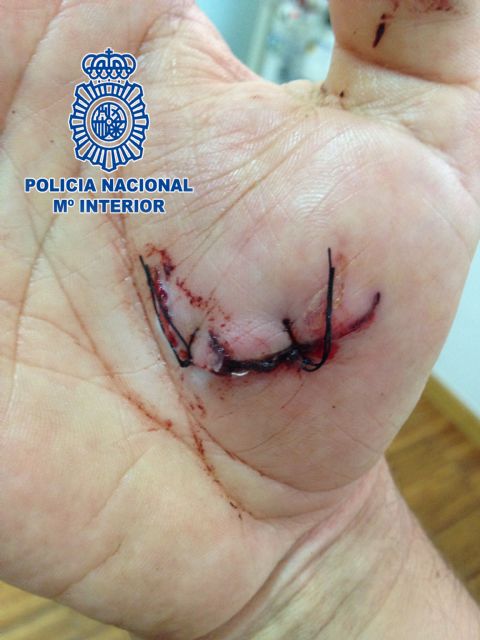 Agente de Policía Nacional herido por un perro al tratar de apartarlo de la vía pública - 2, Foto 2