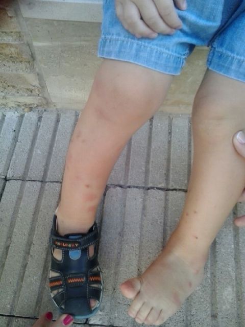 El PSOE exige al Ayuntamiento de Murcia que tome las medidas necesarias para acabar con la plaga de mosquitos - 1, Foto 1