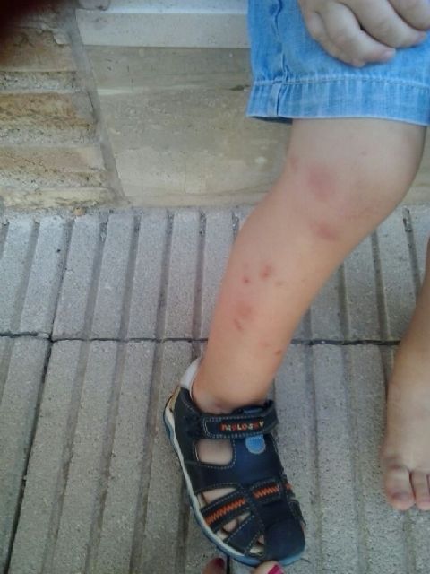 El PSOE exige al Ayuntamiento de Murcia que tome las medidas necesarias para acabar con la plaga de mosquitos - 2, Foto 2
