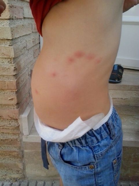 El PSOE exige al Ayuntamiento de Murcia que tome las medidas necesarias para acabar con la plaga de mosquitos - 3, Foto 3