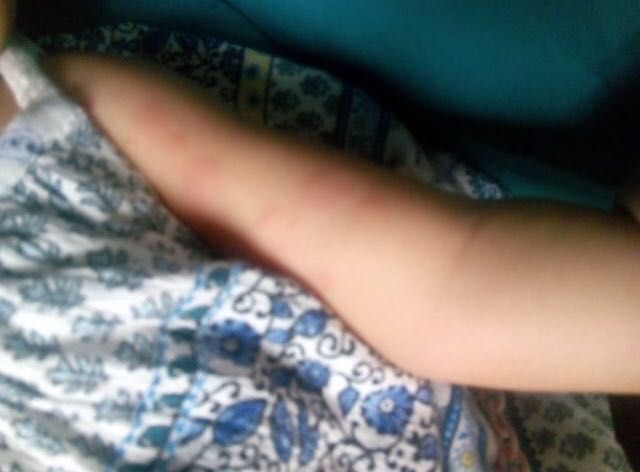 El PSOE exige actuaciones urgentes ante la plaga de pulgas en el nuevo parque de San Diego - 1, Foto 1