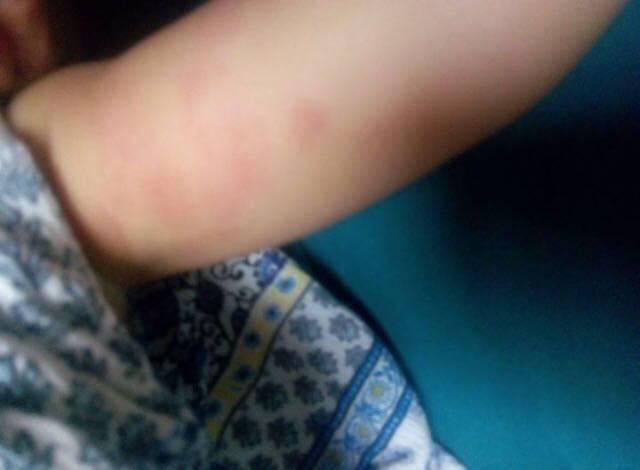 El PSOE exige actuaciones urgentes ante la plaga de pulgas en el nuevo parque de San Diego - 2, Foto 2