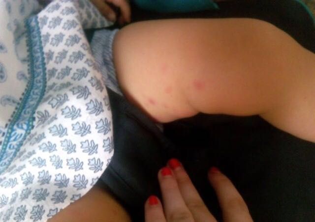 El PSOE exige actuaciones urgentes ante la plaga de pulgas en el nuevo parque de San Diego - 3, Foto 3