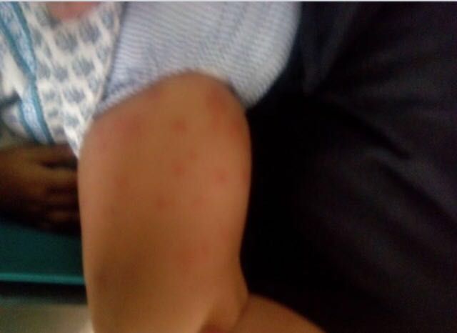 El PSOE exige actuaciones urgentes ante la plaga de pulgas en el nuevo parque de San Diego - 4, Foto 4