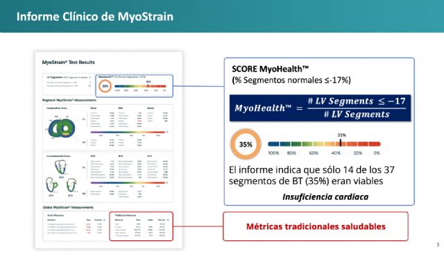 Una resonancia magnética avanzada detecta de forma precoz patologías cardiovasculares invisibles - 2, Foto 2