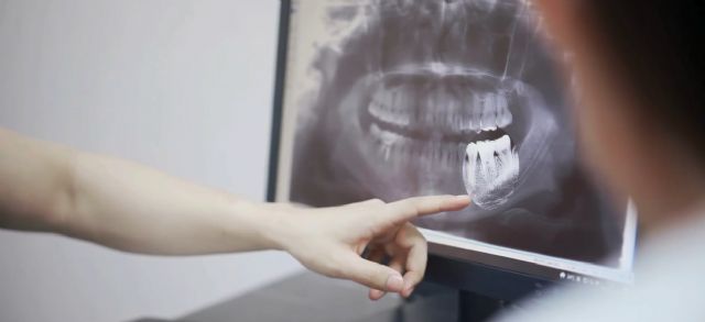 La diabetes también influye en la ortodoncia: investigadores de la UMU a analizan los retos clínicos en pacientes diabéticos - 1, Foto 1