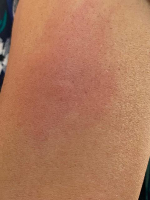 Arrecian los problemas provocados por las nubes de mosquitos, presencia de ratas y acumulación de basura en el tramo urbano de las vías del tren - 4, Foto 4