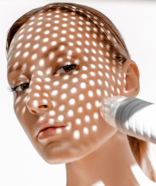 Los tres tratamientos láser más efectivos para este invierno - 1, Foto 1