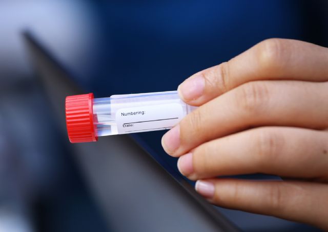 Científicos de la UMU describen una prueba simple para evaluar la gravedad de pacientes con COVID-19 - 1, Foto 1