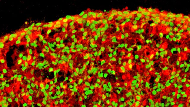 Izpisua, más cerca de curar la diabetes - 1, Foto 1