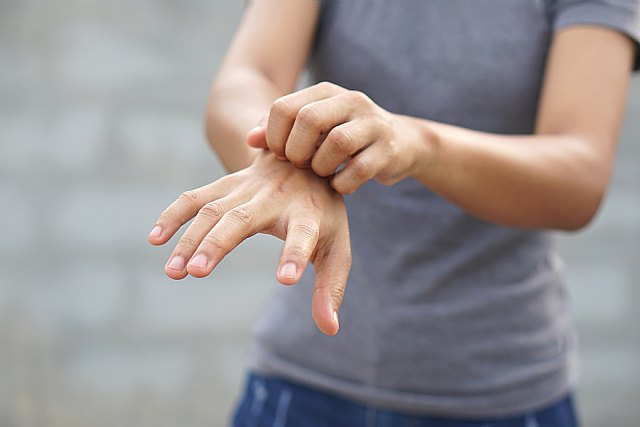 Verano y picaduras: cómo evitar los insectos durante la época de calor - 1, Foto 1