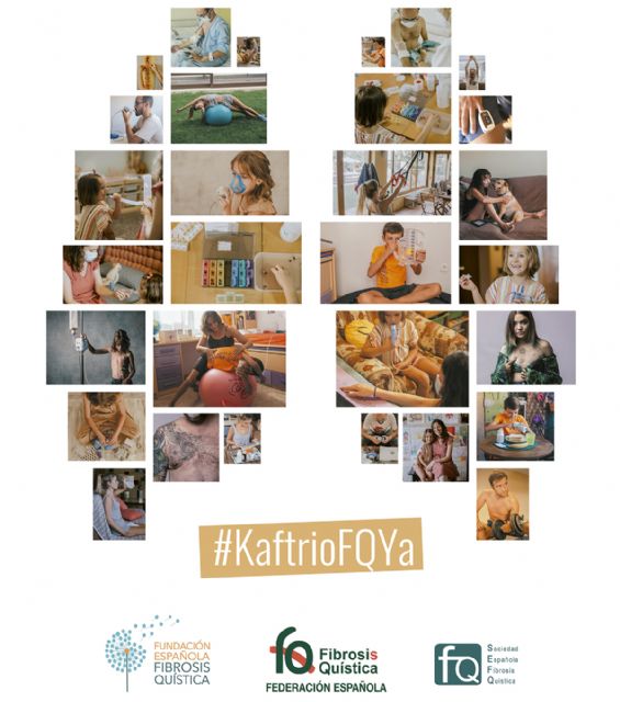 Denuncian que la política sanitaria en España frena la revolución terapéutica de enfermedades como la Fibrosis Quística - 1, Foto 1