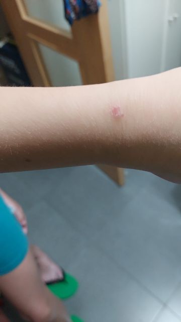 El PP propone que se incremente el número de fumigaciones ante los continuos problemas generados por nubes de insectos en todo el municipio - 1, Foto 1