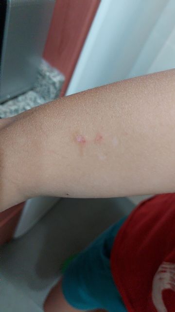 El PP propone que se incremente el número de fumigaciones ante los continuos problemas generados por nubes de insectos en todo el municipio - 5, Foto 5