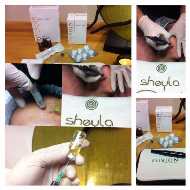 Arrugas, patas de gallo, falta de firmeza, cicatrices ..?, Foto 1