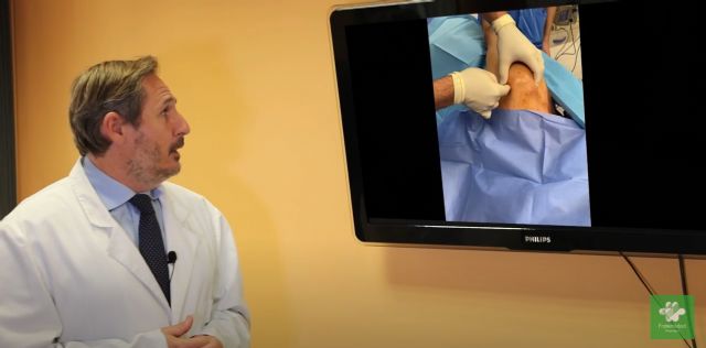 Hospital Fraternidad-Muprespa Habana: la artroscopia sale del quirófano - 1, Foto 1