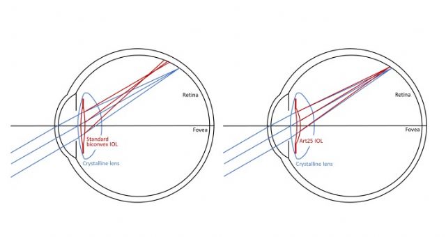 El LOUM de la UMU desarrolla unas nuevas lentes intraoculares - 1, Foto 1