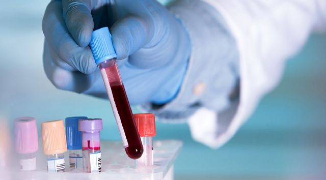 Blueberry Diagnostics lanza el primer test basado en un análisis de sangre para el diagnóstico de COVID-19 - 1, Foto 1