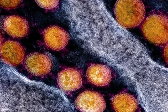 Un equipo del CSIC busca una vacuna para el COVID-19 que usa un antígeno del coronavirus para estimular la inmunidad - 1, Foto 1
