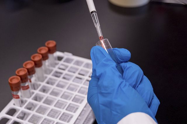 España ha realizado más de tres millones de PCR desde el inicio de la epidemia - 1, Foto 1