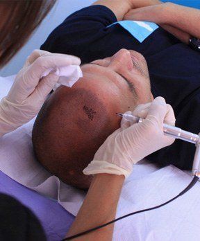 EDM Capilar ofrece financiación para tratamientos de micro-pigmentación capilar - 1, Foto 1