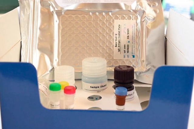 El CSIC pone a disposición de la OMS sus test serológicos de COVID-19 para facilitar su fabricación en África - 1, Foto 1