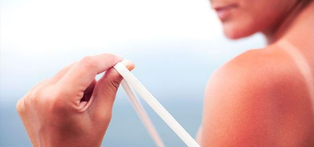 Cáncer de piel: la pandemia estética que se puede evitar - 1, Foto 1