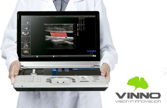 ¿Qué hay que tener en cuenta al comprar un ecógrafo portátil?, por ECOGRÁFOS VINNO - 1, Foto 1