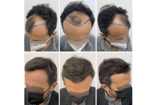 El Dr. Bruno Jacobovski recomienda las vitaminas para la caída de pelo - 1, Foto 1