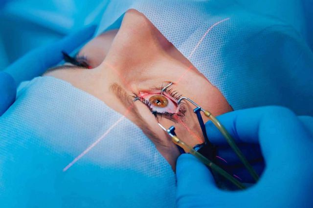 ¿Cuáles son las ventajas de someterse a la cirugía refractiva? - 1, Foto 1