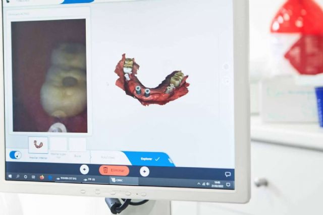 Rehabilitación oral en un solo día, de la mano de BORDONCLINIC - 1, Foto 1