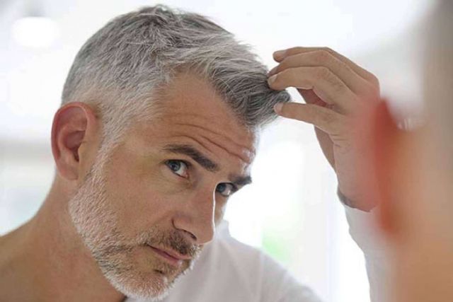 Tratamiento pre y post implante capilar, en Wiotech España - 1, Foto 1