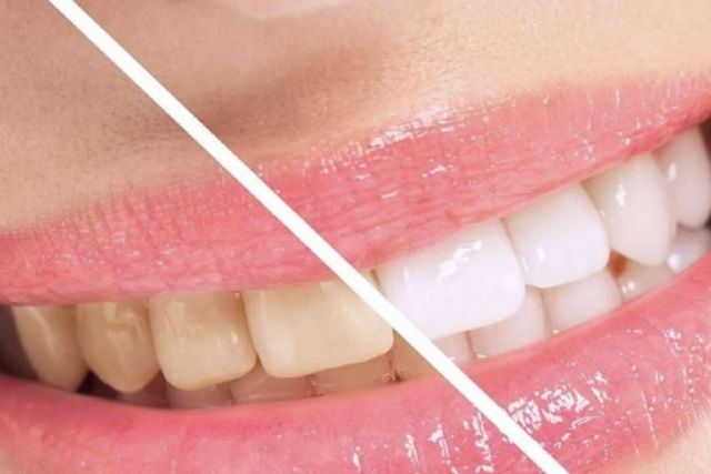 La importancia de realizarse tratamientos dentales de la mano de expertos, como DeltaDent - 1, Foto 1