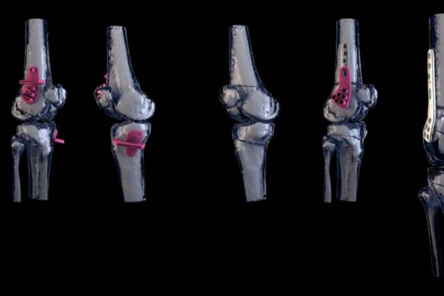 KOOBO®, mejorando la salud - 1, Foto 1