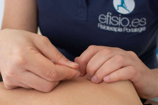 EFISIO explica para qué sirve la técnica de la punción seca - 1, Foto 1