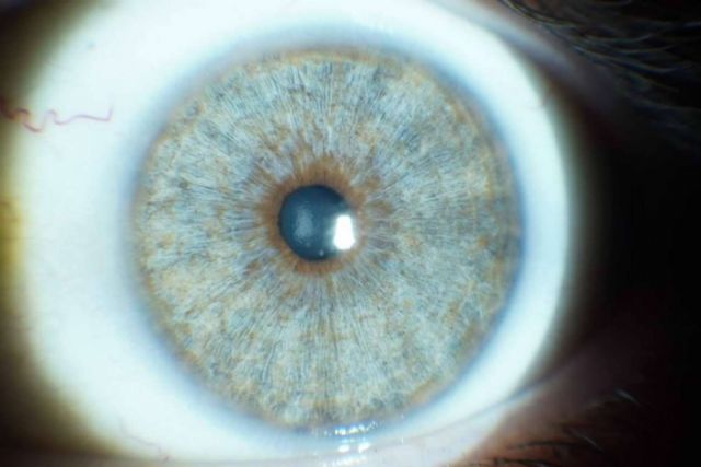Los avances en las operaciones de cambio de color de ojos con láser, con Clínica Eyecos - 1, Foto 1